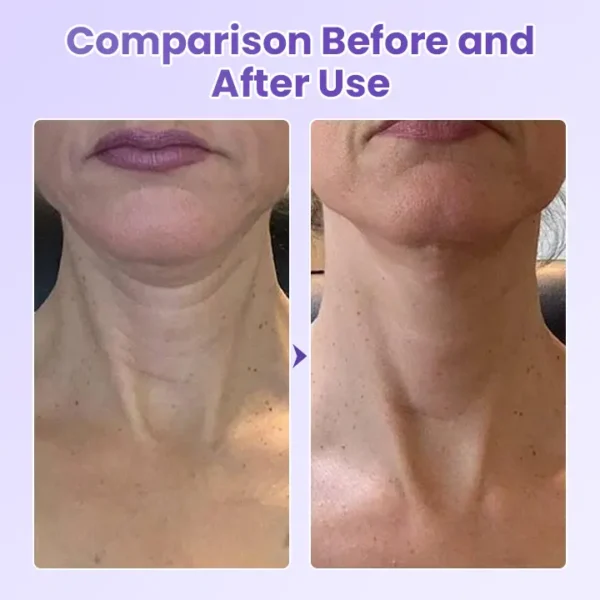 Biancat® NeckYouth Peptide Anti-Wrinkle Patch