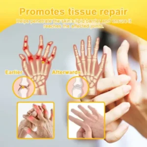 Super Deal ODALIT™ Botulinum Toxin & Bee Venom Pain-Relief Bone Healing Cream