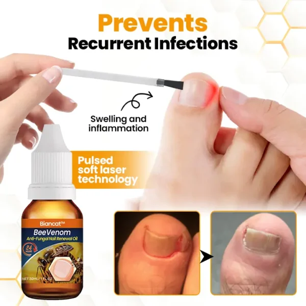 Biancat® BeeVenom Anti-Fungal Nail Renewal Oil