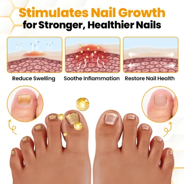 Biancat® BeeVenom Anti-Fungal Nail Renewal Oil