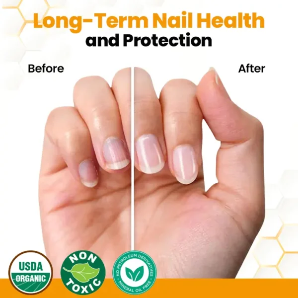 Biancat® BeeVenom Anti-Fungal Nail Renewal Oil