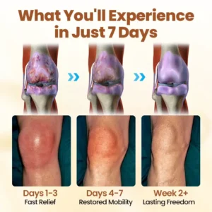 Biancat® Premium Curcumin Pain Relief Gel