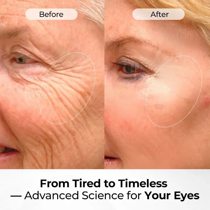 Biancat® TightShift Precision Contour & Firming Serum