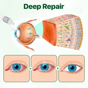 Biancat™ Vision Enhancing Multifunctional Eye Drops-(A)