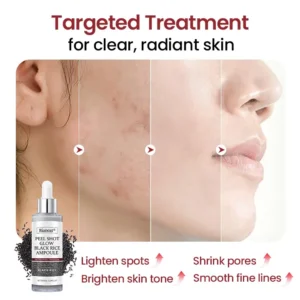 Grunsify® Peel Shot Glow Black Rice Ampoule