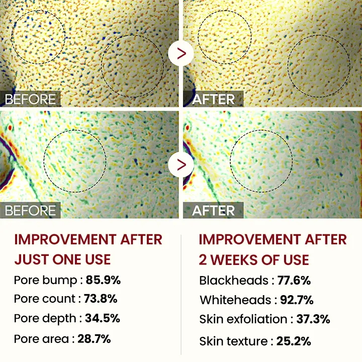 Grunsify® Peel Shot Glow Black Rice Ampoule