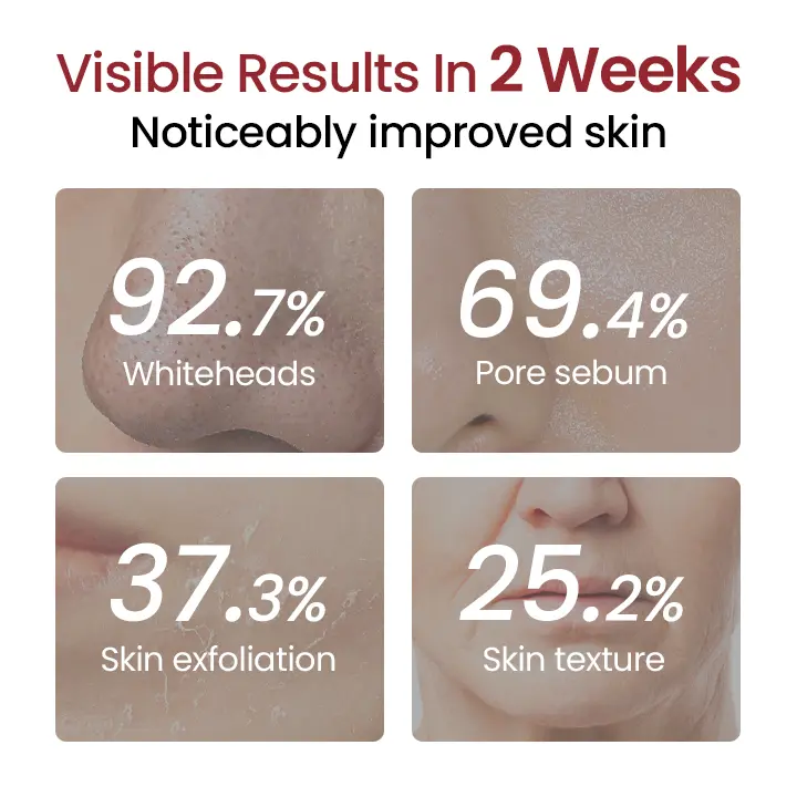 Grunsify® Peel Show Glow Black Rice Ampoule