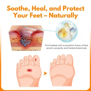 Biancat® VenHeal Bee Venom Diabetic Wound Spray