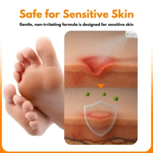 Biancat® VenHeal Bee Venom Diabetic Wound Spray