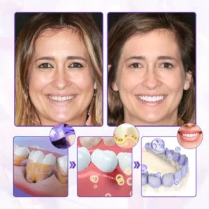 Biancat® BeeRenew Advanced Gum Healing Toothpaste