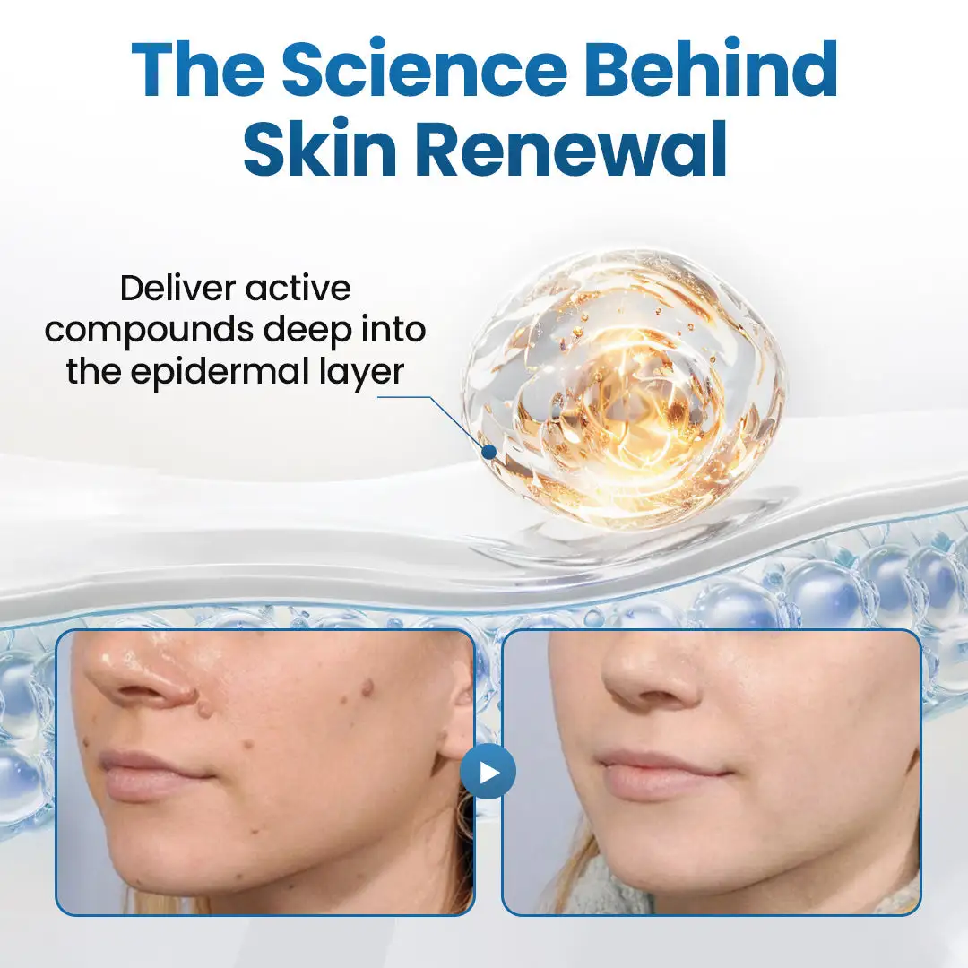 Biancat® BumpFlatten Cream🇬🇧 XH-BumpFlatten-UPSELL