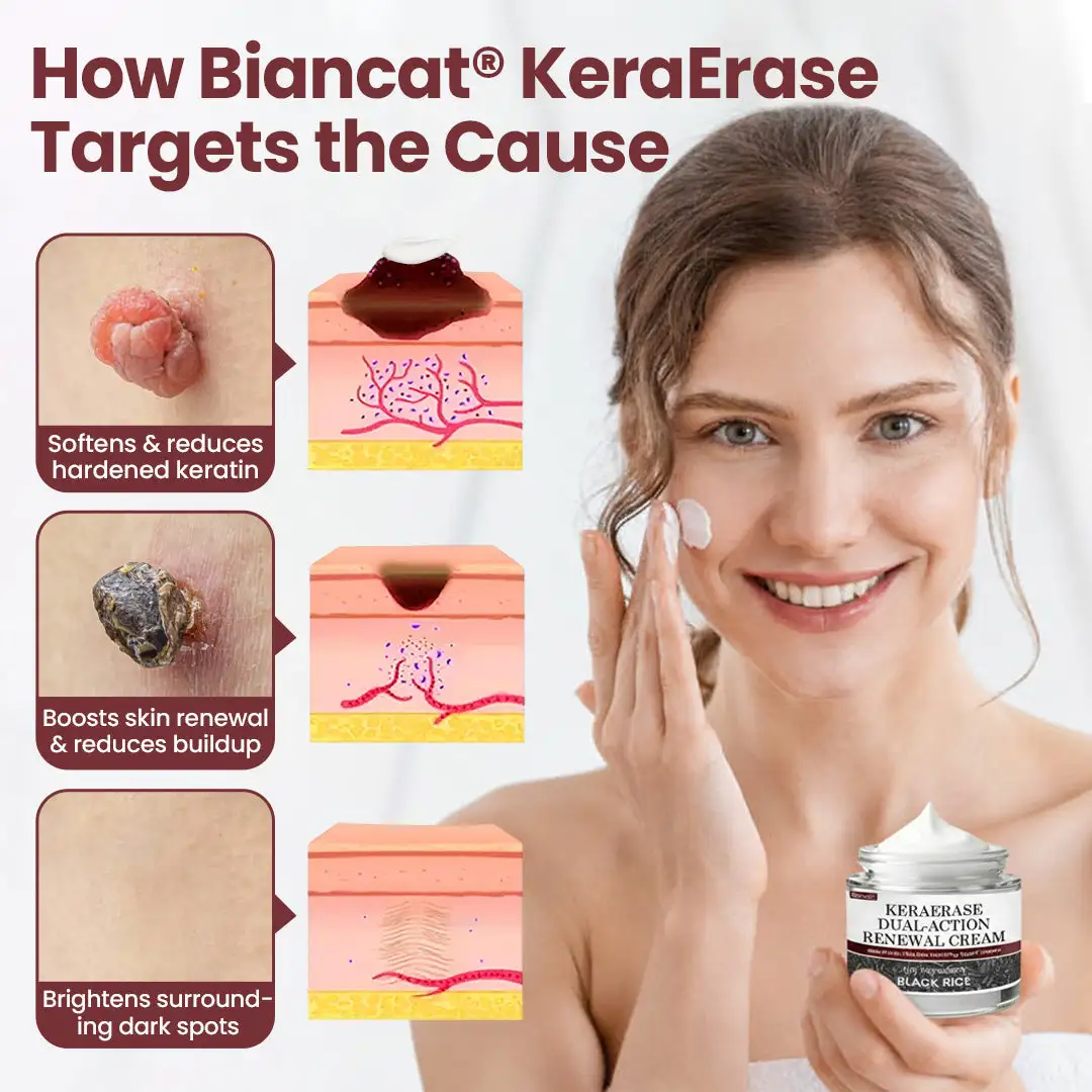 Biancat®KeraErase Dual-Action Renewal Cream
