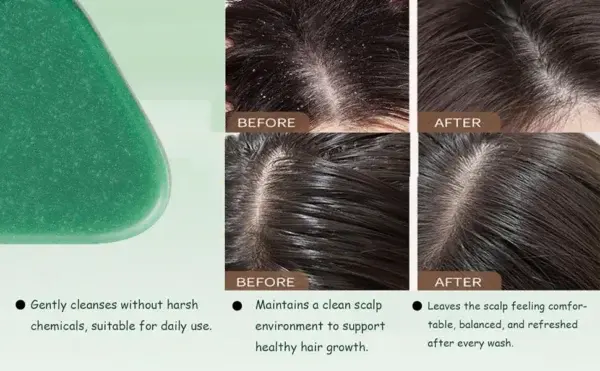 ๐ช๐๐๐๐๐ยฎ ๐๐๐ญ๐ ๐๐ข๐ซ๐ณ๐ ๐๐๐๐๐ซ๐ฏ๐๐ฌ๐๐๐ง๐ญ ๐ญ๐๐๐ฅ๐๐ญ๐ฌ