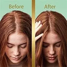 ๐ช๐๐๐๐๐ยฎ ๐๐๐ญ๐ ๐๐ข๐ซ๐ณ๐ ๐๐๐๐๐ซ๐ฏ๐๐ฌ๐๐๐ง๐ญ ๐ญ๐๐๐ฅ๐๐ญ๐ฌ