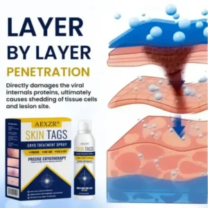 AEXZR® Skin Tag Cryo Treatment Spray