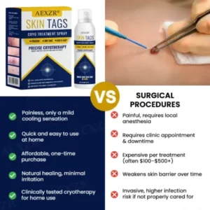 AEXZR® Skin Tag Cryo Treatment Spray