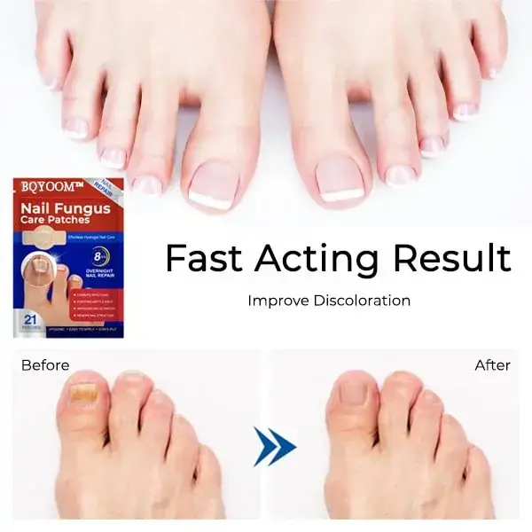 BQYOOM™ Nail Fungus Care Patches