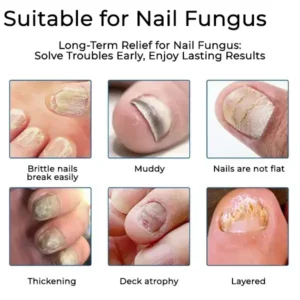 BQYOOM™ Nail Fungus Care Patches