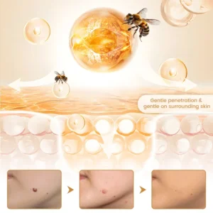 Biancat® BeeVenom Wart Drop Serum (A)