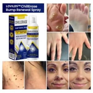LOVILDS™ ChillErase Bump Renewal Spray