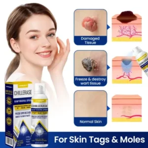 LOVILDS™ ChillErase Bump Renewal Spray