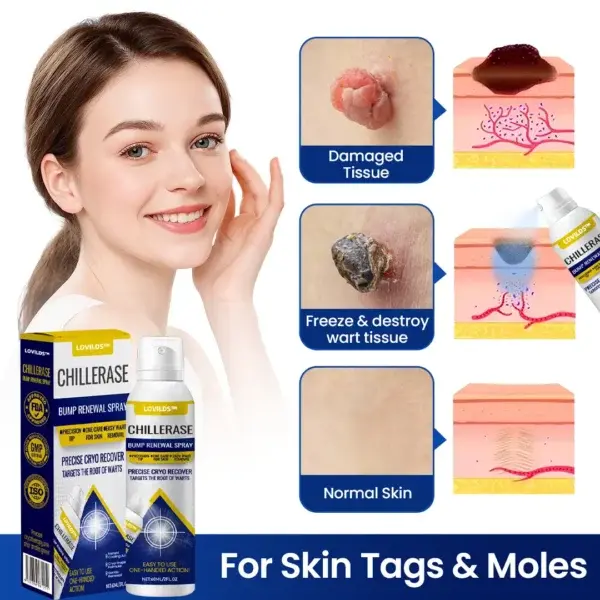 LOVILDS™ ChillErase Bump Renewal Spray