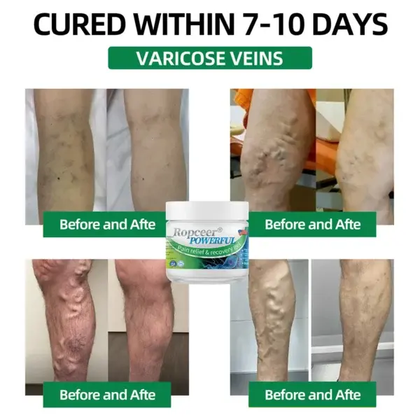 Ropceer® Powerful pain relief& recovery gel
