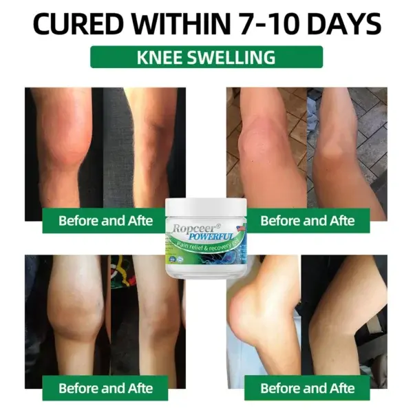 Ropceer® Powerful pain relief& recovery gel