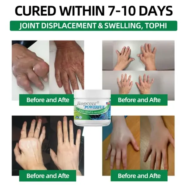 Ropceer® Powerful pain relief& recovery gel