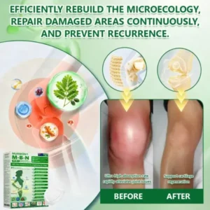 𝑴𝙐𝗥𝓦𝐎𝙉® — 𝑩𝒆𝒓𝙗𝙚𝙧𝒊𝙣𝐞 𝐀𝐝𝐯𝐚𝐧𝐜𝐞𝐝 𝑵𝒂𝒏𝒐-𝙉𝙚𝙚𝙙𝙡𝙚 𝙏𝙚𝙘𝙝𝙣𝙤𝙡𝙤𝙜𝙮