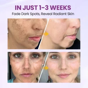 Biancat® RadiantClear Blemish & Brightening Serum