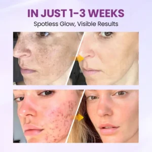 Biancat® RadiantClear Blemish & Brightening Serum