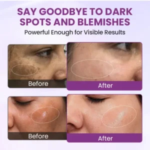 Biancat® RadiantClear Blemish & Brightening Serum