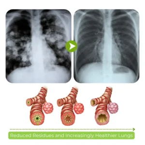 Biancat® RespiCleanse Herbal Lung Detox Inhaler.