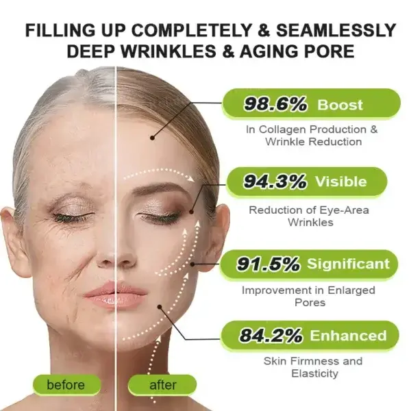Rolimey® Botox & Vita-A Retinol Shot Tightening and Wrinkle-Reducing Cream