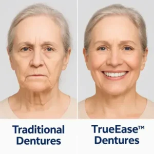 TrueEase™ Dentures